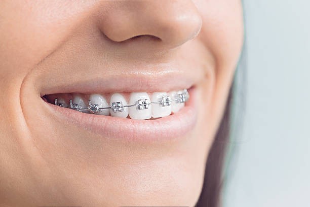 Best Full Mouth Reconstruction  in National Harbor, MD